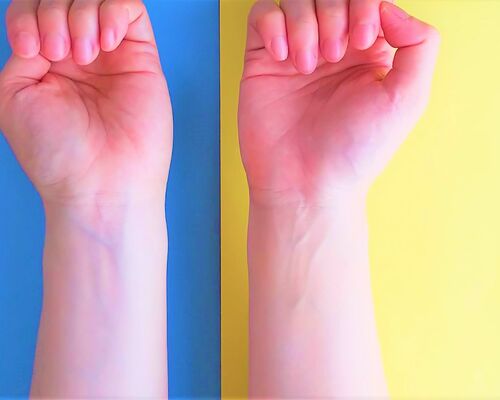 ブルーイエローベース